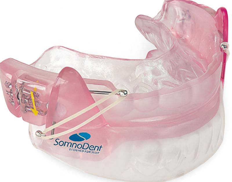 DAM Dispositivo Avance Mandibular