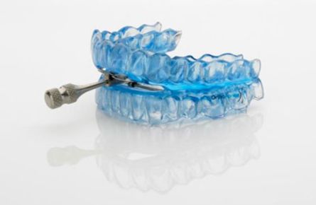 Dispositivo de Avance Mandibular