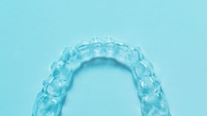 Férula para el bruxismo