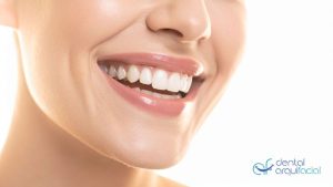 blanqueamiento dental profesional