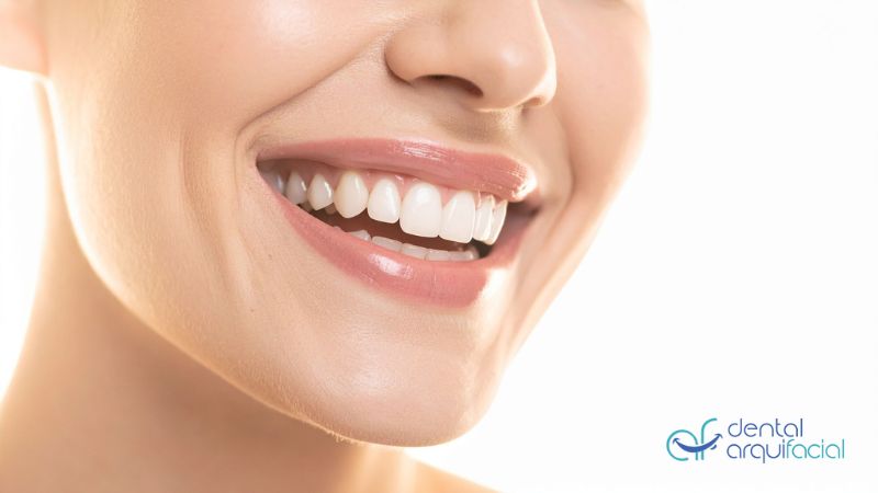 blanqueamiento dental profesional