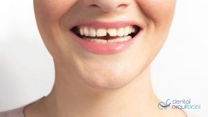 diente roto en navidad